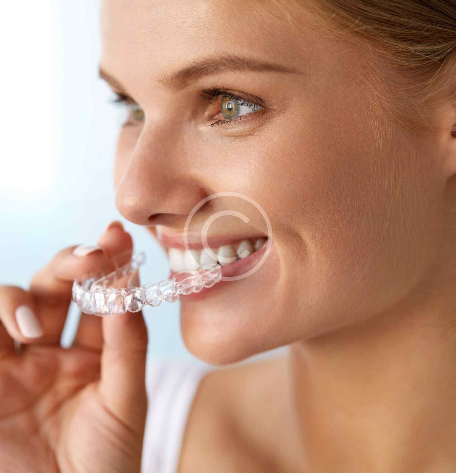 Implantes dentales